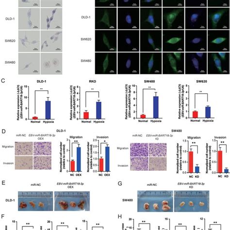 EBVmiRBART183p Enhances The Malignant Phenotype Of CRC In Vitro And