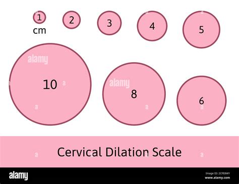 Dilated Cervix Diagram