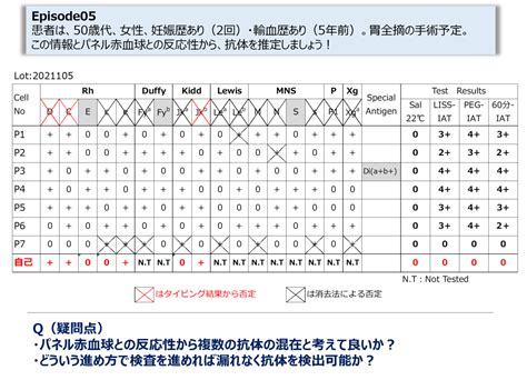 #105：ケーススタディー（Episode：05）複数抗体が示唆された際には、まずは酵素処理赤血球を活用する（抗E＋抗Fyb） - 血液型検査 ...