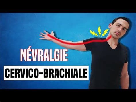 TRAITEMENT DE LA NÉVRALGIE CERVICO BRACHIAL EXERCICE KINÉ YouTube