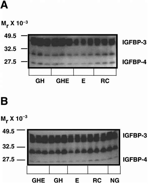 Serum Insulin Like Growth Factor Binding Protein Igfbp Profiles Of