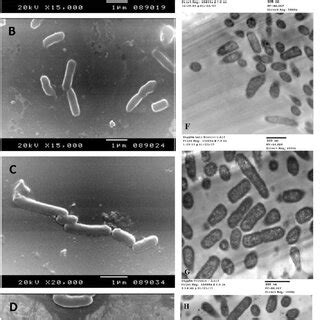 Scanning electron microscope images (A-D) and transmission electron ...