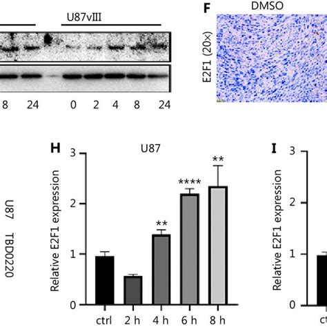 E2F1 is among the most important transcription factors in EGFRvIII ... 