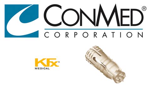 Conmed Acquires Kfxs Appianfx Soft Tissue Fixation Device Massdevice