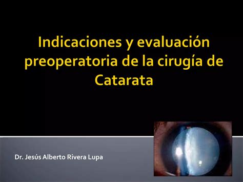 EvaluaciÓn Pre Operatoria De La Catarata Y Su RepercusiÓn Funcional Ppt