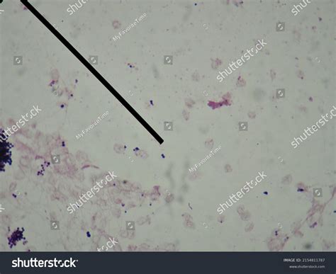 Gram Positive Diplococci Gram Stain Preparation Stock Photo 2154811787 ...