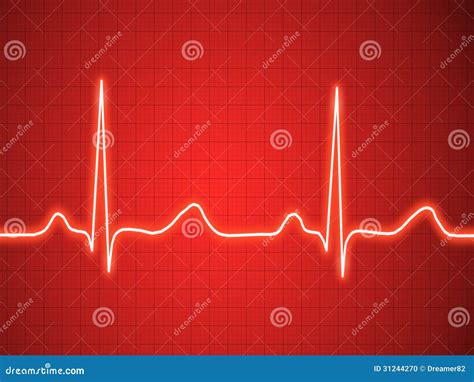 Electrocardiogram Ecg Graph Pulse Tracing Stock Illustration