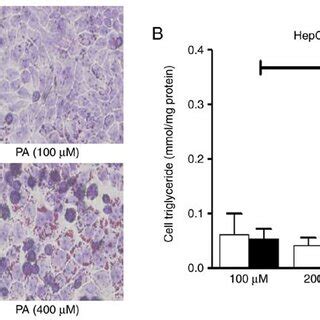 Pa Induces Intracellular Lipid Accumulation In Hepg Cells A Hepg