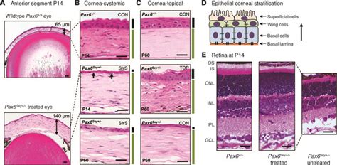 Jci Postnatal Manipulation Of Pax Dosage Reverses Congenital Tissue