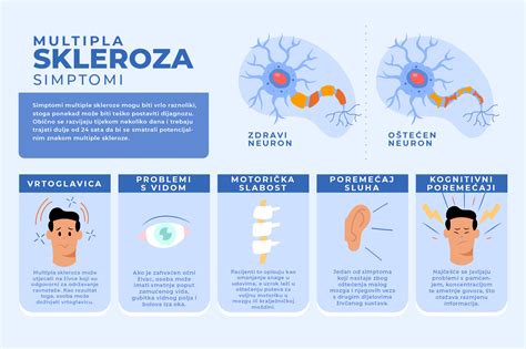 Multipla Skleroza Simptomi I Izazovi Virtualna Ordinacija