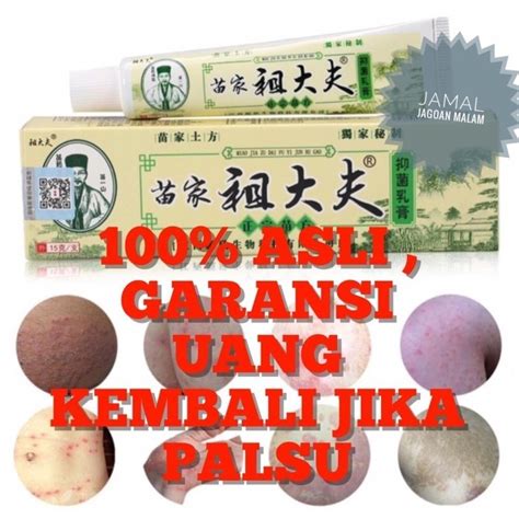 Jual Obat Salep Gatal Gatel Kulit Kurap Jamur Bakteri CHY GAO Herbal