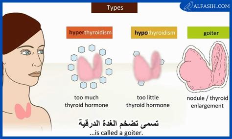 أعراض الغدة الدرقية عند النساء موقع الفصيح