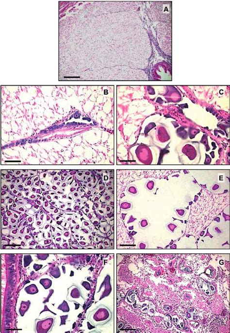 Photomicrographs Of Gonadal Stages In A Female Cerastoderma Edule A