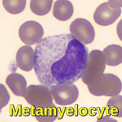 Blood Morphology Ask Hematologist Understand Hematology