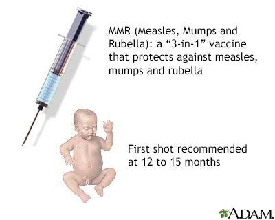 Vaccines Immunizations Overview Information Mount Sinai New York