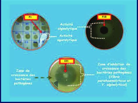 Activit Exo Enzymatique Et D Inhibition Des Bact Ries Probiotiques