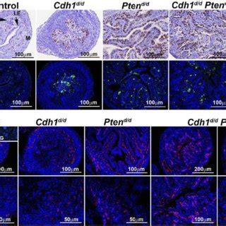 The Effect Of Cdh And Or Pten Ablation On Proliferation Apoptosis