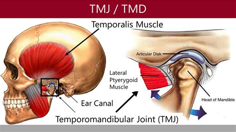 Can Wisdom Teeth Cause Tmj Boston Dentist Congress Dental Group