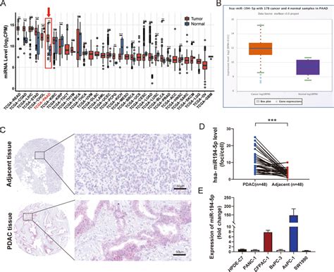 Expression Of Mir 194 5p In Pdac Tissues And Pdac Cell Lines A The Bar