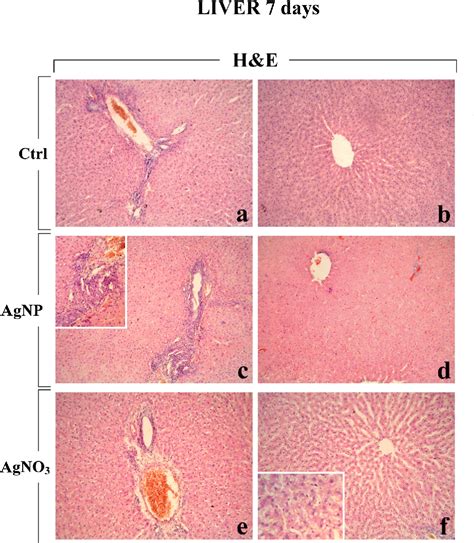 Figure 5 From Pulmonary And Hepatic Effects After Low Dose Exposure To