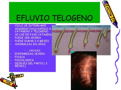 PPT ALTERACIONES DEL SISTEMA PILOSO PowerPoint Presentation Free