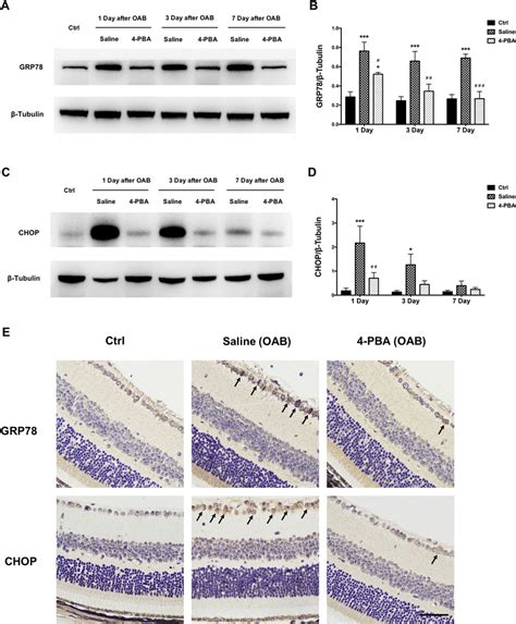 4 Pba Decreased The Protein Expression Of Er Stress Mediated Apoptosis Download Scientific