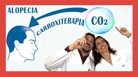 MIRA Los RESULTADOS De Carboxiterapia En Cabello Para Alopecia YouTube