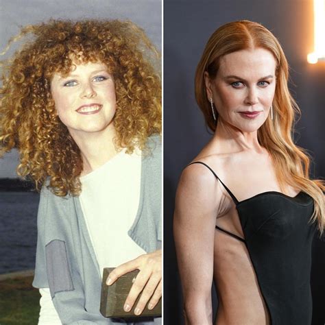 Did Nicole Kidman Get Plastic Surgery See Before And After Photos Of