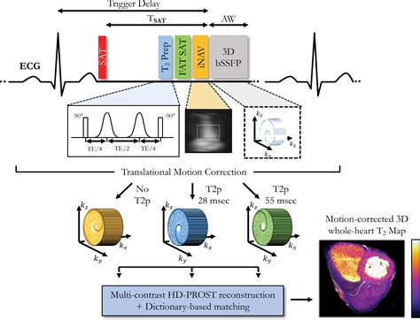 High Spatial Resolution 3d Whole Heart Mri T2 Mapping For Assessment Of