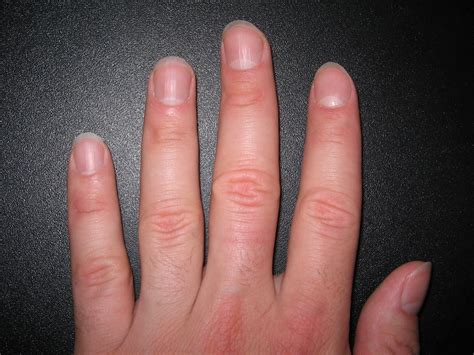 Filefingernails2 Wikipedia