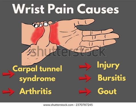 Wrist Pain Causes Vector Illustration Causes Stock Vector (Royalty Free ...