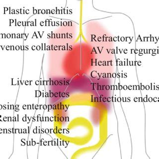 Complications of the Fontan palliation | Download Table