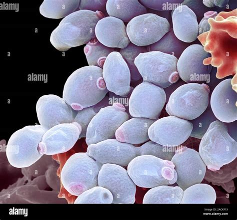 Candida Albicans Yeast Cells Coloured Scanning Electron Micrograph