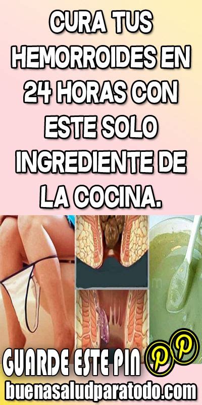 Cura Tus Hemorroides En 24 Horas Con Este Solo Ingrediente De La Cocina