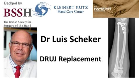 Druj Replacement By Dr Luis Scheker Youtube