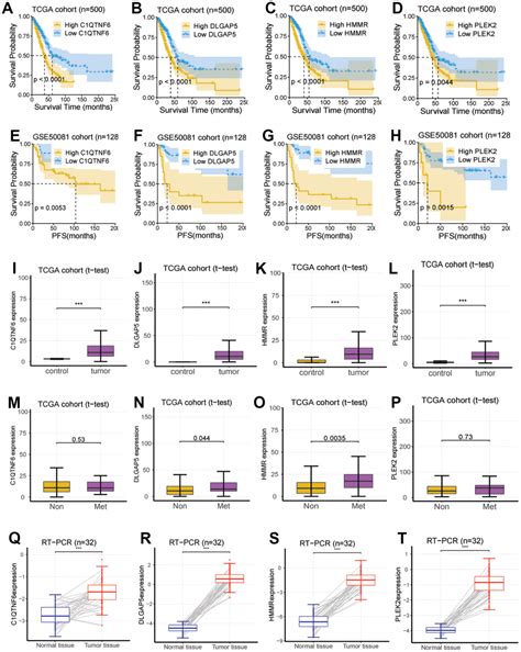 Identification Of Epithelial Mesenchymal Transition Related Biomarkers