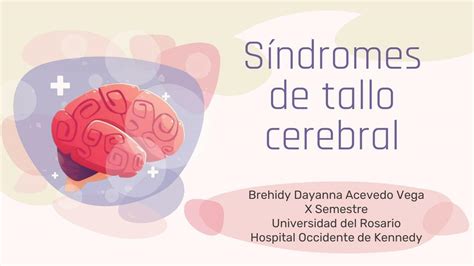 Síndromes de Tallo Cerebral Brehidy Acevedo uDocz