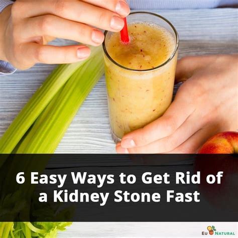 6 Easy Ways To Get Rid Of A Kidney Stone Fast Eu Natural Treat