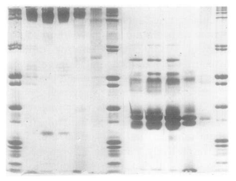 Sds Polyacrylamide Gel Electrophoresis 5 Download Scientific Diagram