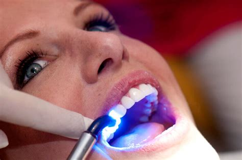 How To Choose The Right Cosmetic Dentist Glamsmile