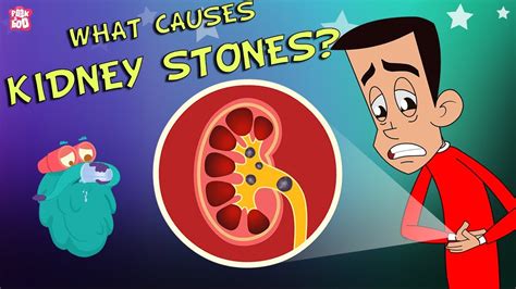 What Causes Kidney Stones The Dr Binocs Show Best Learning Videos