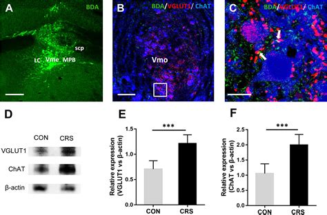 Frontiers Activation Of The Mesencephalic Trigeminal Nucleus Contributes To Masseter