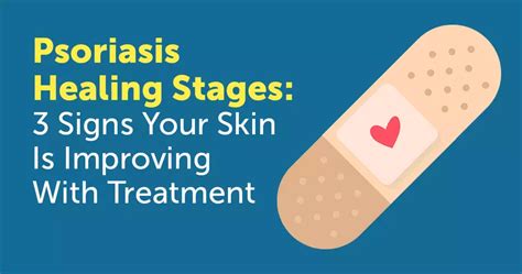 Psoriasis Healing Stages: 3 Signs Your Skin Is Improving With Treatment ...