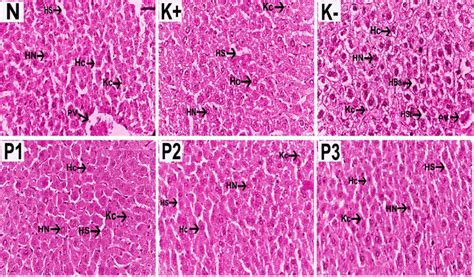 Histology Of Liver Using H And E Staining On Normal And Experimental