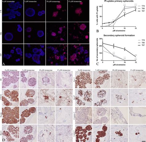 Effect Of Siramesine On Patient Derived Spheroid Cultures The