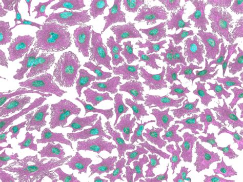 Register Of Misidentified Cell Lines Iclac