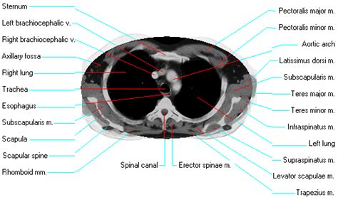 Ct Thorax Anatomy