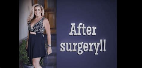 Success Story Jennifer L Central California Surgery Bariatric Surgeons