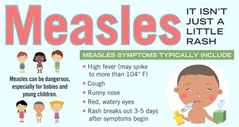 Public Health Advisory Rise In U S Measles Cases Nantucket Cottage Hospital