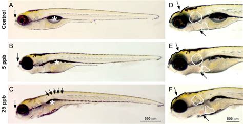 Zebrafish Larvae Anatomy